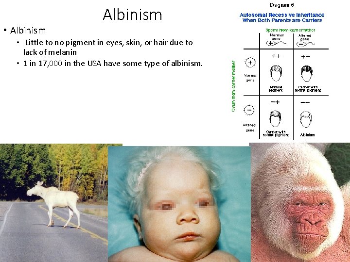  • Albinism • Little to no pigment in eyes, skin, or hair due
