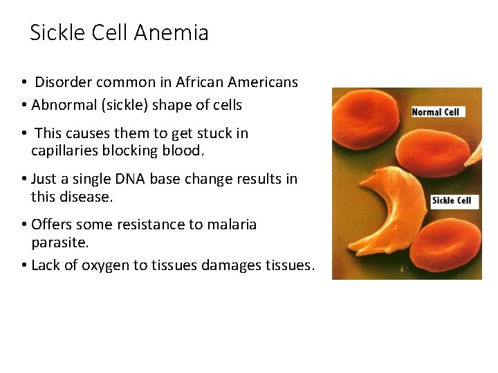 Sickle Cell Anemia • Disorder common in African Americans • Abnormal (sickle) shape of