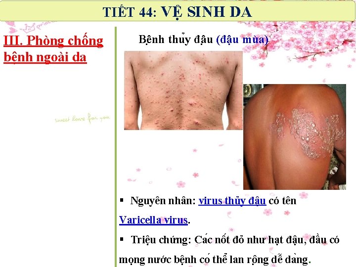 TIẾT 44: VỆ SINH DA III. Phòng chống bệnh ngoài da Bê nh thu TIẾT 44: VỆ SINH DA III. Phòng chống bệnh ngoài da Bê nh thu