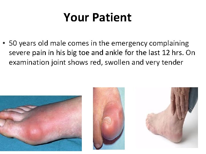 Your Patient • 50 years old male comes in the emergency complaining severe pain