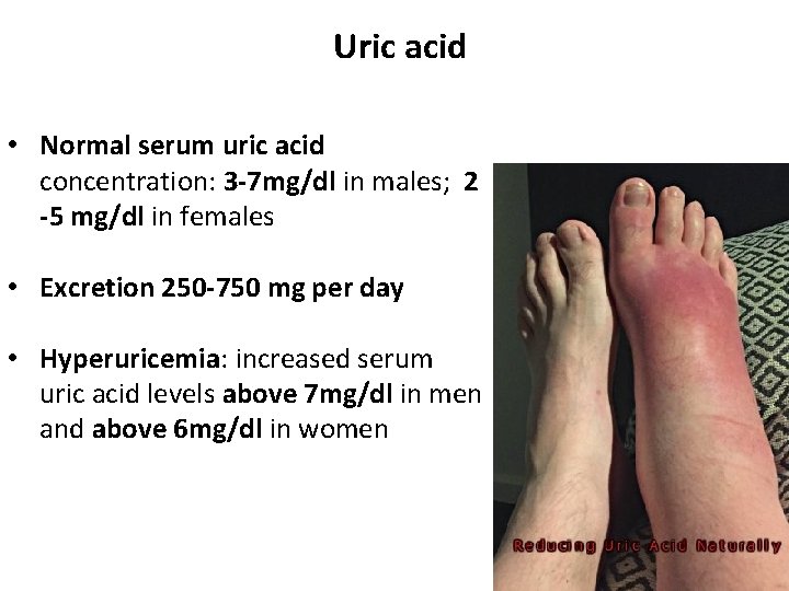 Uric acid • Normal serum uric acid concentration: 3 -7 mg/dl in males; 2