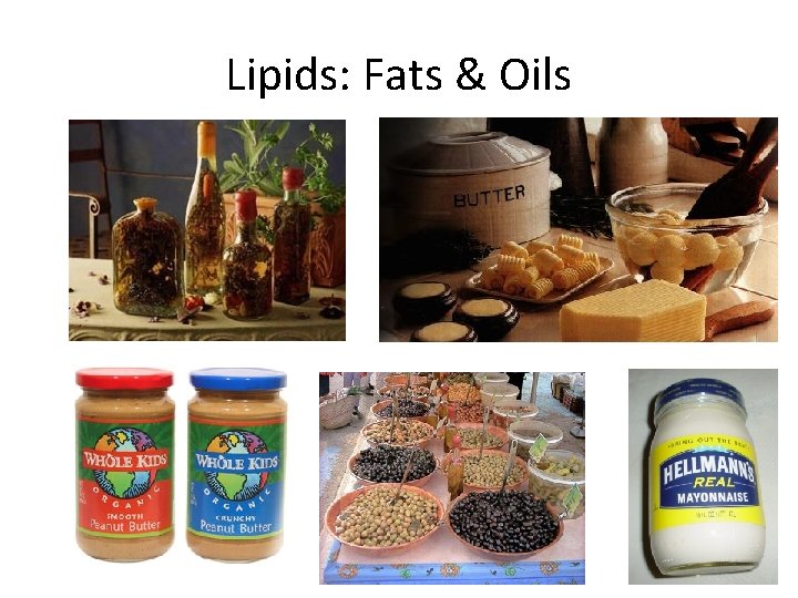 Lipids: Fats & Oils 