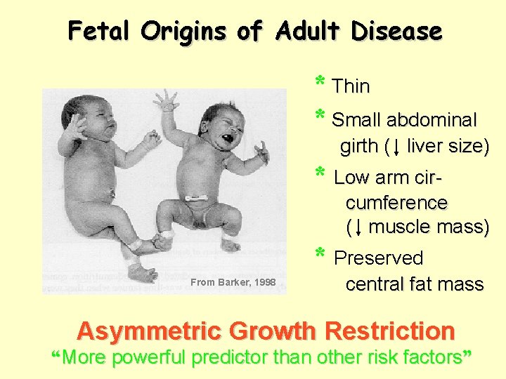 Fetal Origins of Adult Disease * Thin * Small abdominal girth ( liver size)