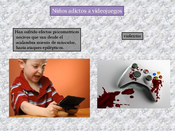 Niños adictos a videojuegos Han sufrido efectos psicomotrices nocivos que van desde el acalambra