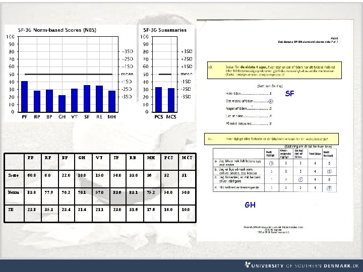 SF PF RP BP GH VT SF RE MH PCS MCS Score 60. 0