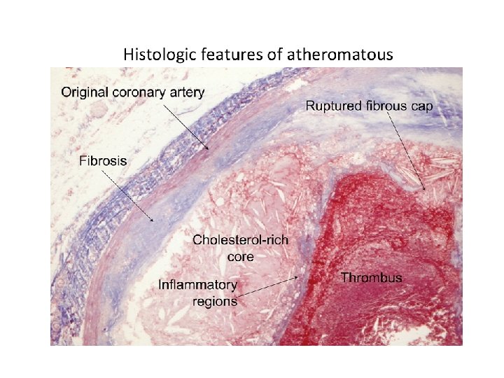 Аорта рисунок гистология