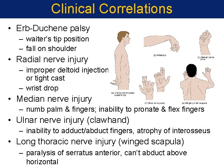 Clinical Correlations • Erb-Duchene palsy – waiter’s tip position – fall on shoulder • Clinical Correlations • Erb-Duchene palsy – waiter’s tip position – fall on shoulder •