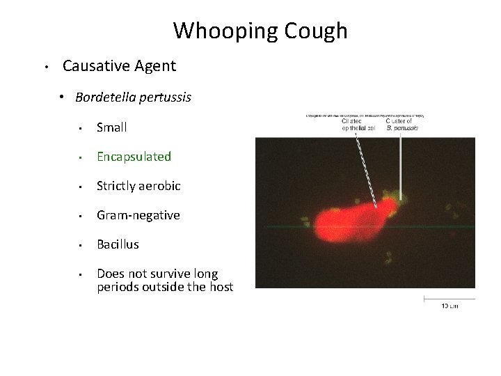 Whooping Cough • Causative Agent • Bordetella pertussis • Small • Encapsulated • Strictly