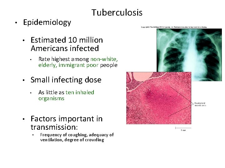 • Epidemiology • Estimated 10 million Americans infected Rate highest among non-white, elderly,