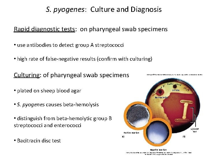 S. pyogenes: Culture and Diagnosis Rapid diagnostic tests: on pharyngeal swab specimens • use