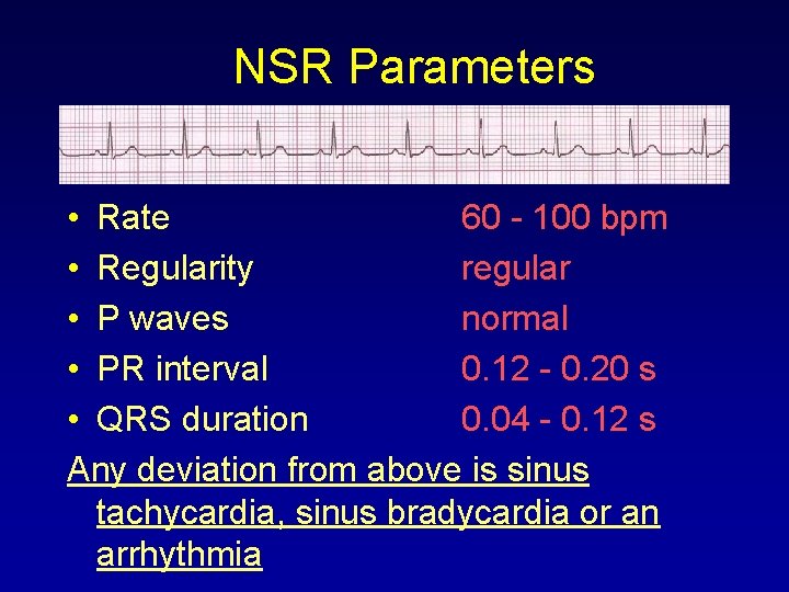 NSR Parameters • Rate 60 - 100 bpm • Regularity regular • P waves