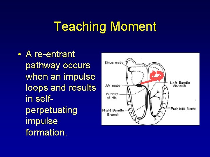 Teaching Moment • A re-entrant pathway occurs when an impulse loops and results in