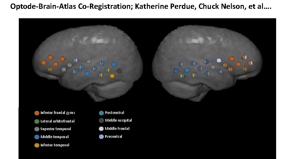 Optode-Brain-Atlas Co-Registration; Katherine Perdue, Chuck Nelson, et al…. Inferior frontal gyrus Postcentral Lateral orbitofrontal Optode-Brain-Atlas Co-Registration; Katherine Perdue, Chuck Nelson, et al…. Inferior frontal gyrus Postcentral Lateral orbitofrontal