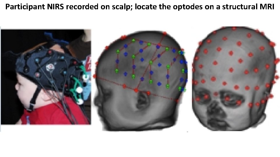 Participant NIRS recorded on scalp; locate the optodes on a structural MRI Participant NIRS recorded on scalp; locate the optodes on a structural MRI