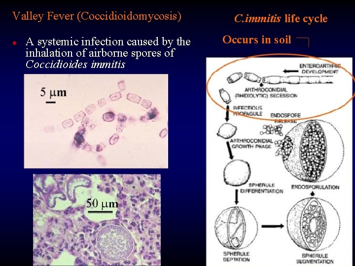 Valley Fever (Coccidioidomycosis) l A systemic infection caused by the inhalation of airborne spores