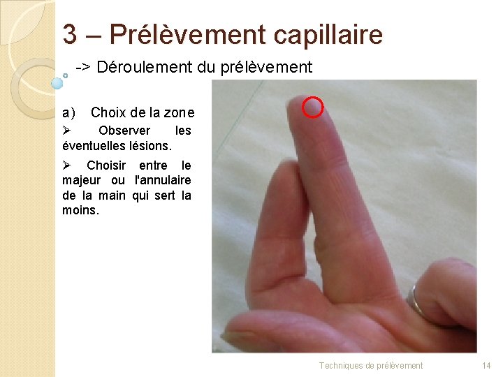 3 – Prélèvement capillaire -> Déroulement du prélèvement a) Choix de la zone Ø