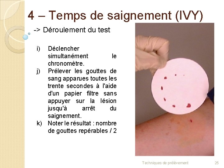 4 – Temps de saignement (IVY) -> Déroulement du test i) Déclencher simultanément le