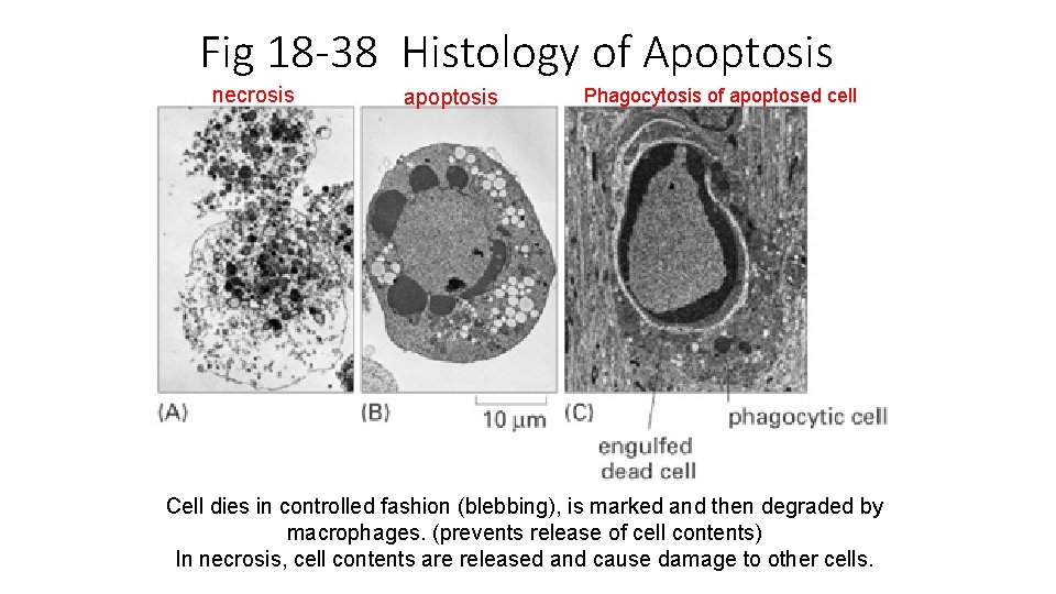 Fig 18 -38 Histology of Apoptosis necrosis apoptosis Phagocytosis of apoptosed cell Cell dies