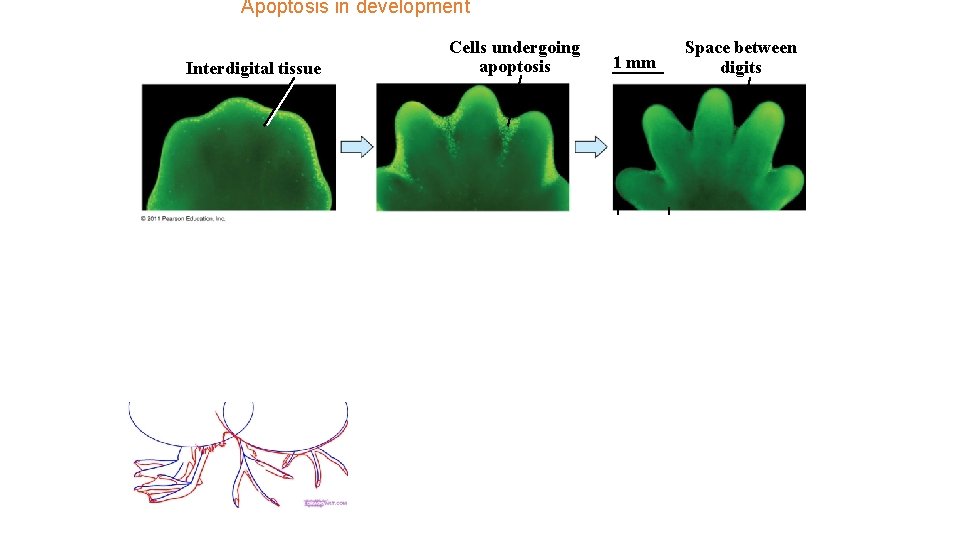 Apoptosis in development Interdigital tissue Cells undergoing apoptosis syndactyly 1 mm Space between digits