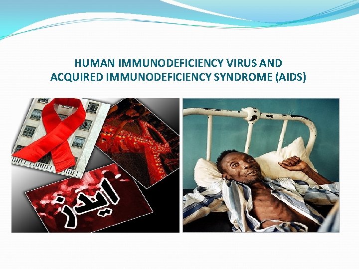 HUMAN IMMUNODEFICIENCY VIRUS AND ACQUIRED IMMUNODEFICIENCY SYNDROME (AIDS) 