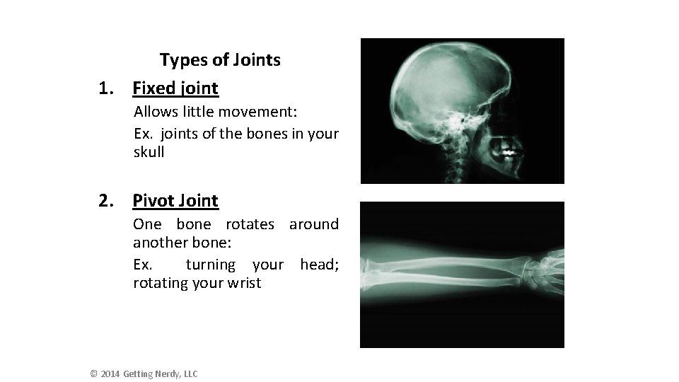 Types of Joints 1. Fixed joint Allows little movement: Ex. joints of the bones