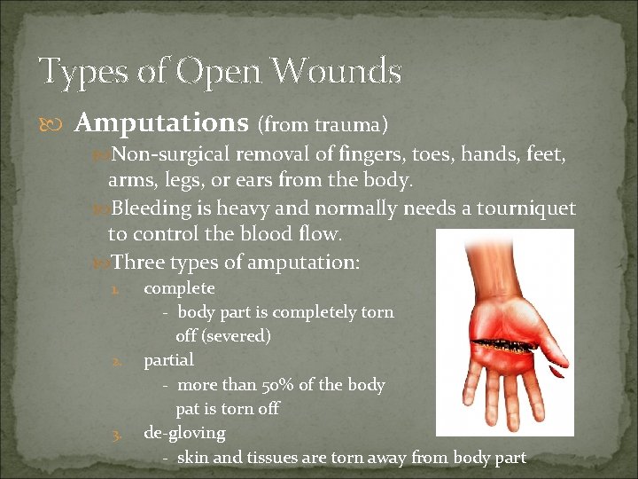 Types of Open Wounds Amputations (from trauma) Non-surgical removal of fingers, toes, hands, feet,