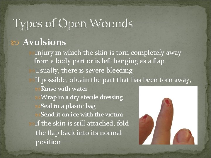 Types of Open Wounds Avulsions Injury in which the skin is torn completely away