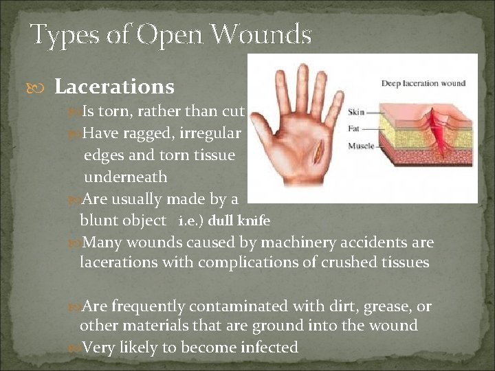 Types of Open Wounds Lacerations Is torn, rather than cut Have ragged, irregular edges