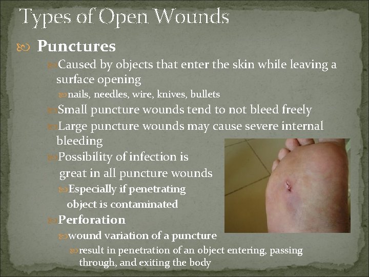 Types of Open Wounds Punctures Caused by objects that enter the skin while leaving
