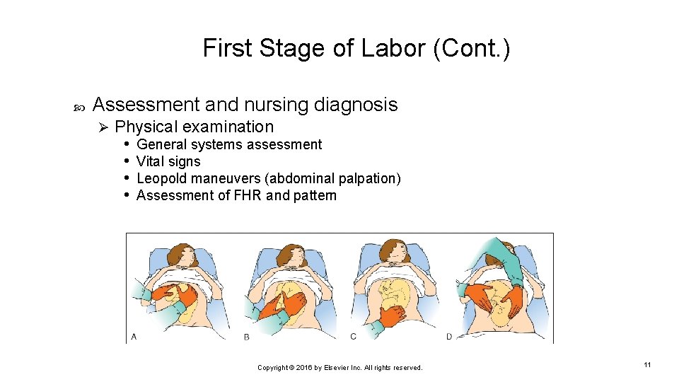 First Stage of Labor (Cont. ) Assessment and nursing diagnosis Ø Physical examination •