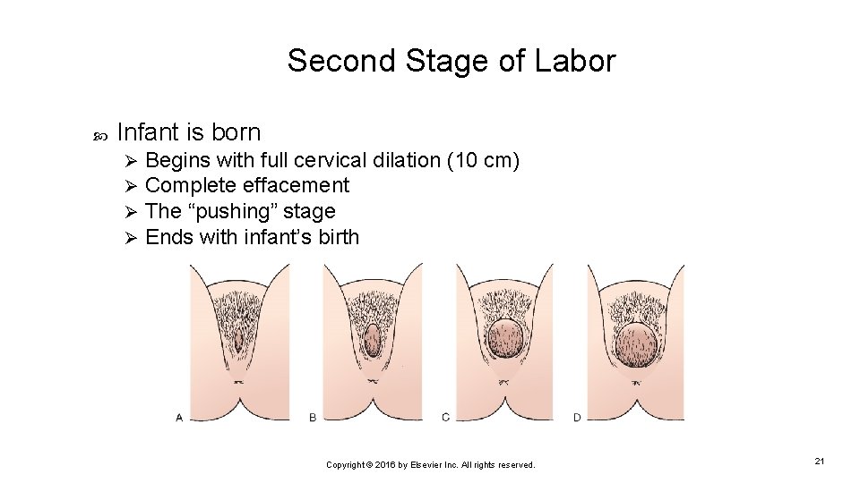 Second Stage of Labor Infant is born Ø Ø Begins with full cervical dilation