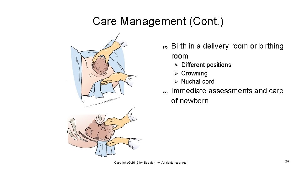 Care Management (Cont. ) Birth in a delivery room or birthing room Different positions