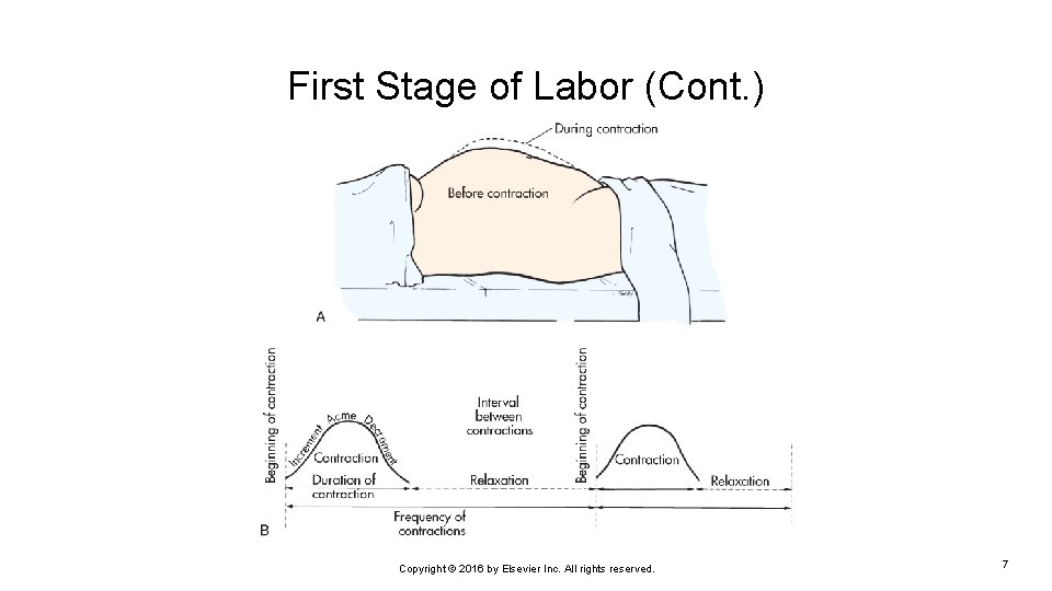 First Stage of Labor (Cont. ) Copyright © 2016 by Elsevier Inc. All rights