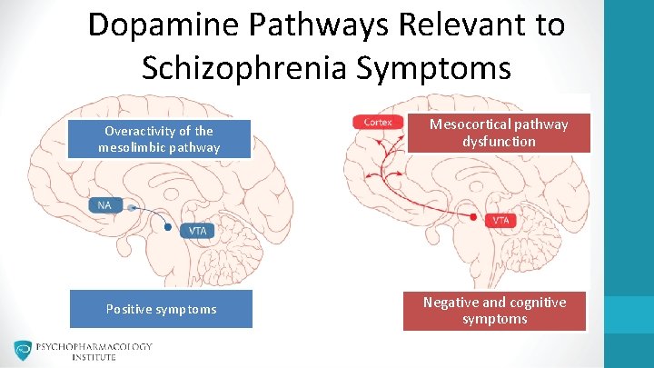 Dopamine Pathways Relevant to Schizophrenia Symptoms Overactivity of the mesolimbic pathway Mesocortical pathway dysfunction