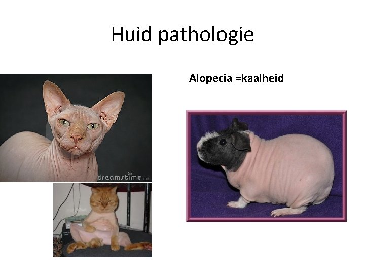 Huid pathologie alopecia Alopecia =kaalheid 