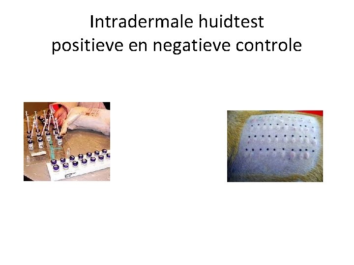 Intradermale huidtest positieve en negatieve controle 