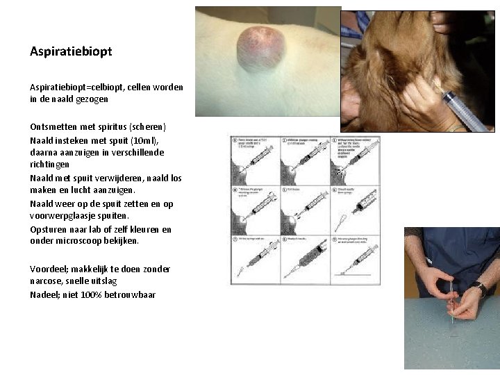 Aspiratiebiopt=celbiopt, cellen worden in de naald gezogen Ontsmetten met spiritus (scheren) Naald insteken met