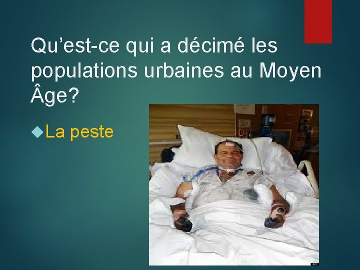 Qu’est-ce qui a décimé les populations urbaines au Moyen ge? La peste 