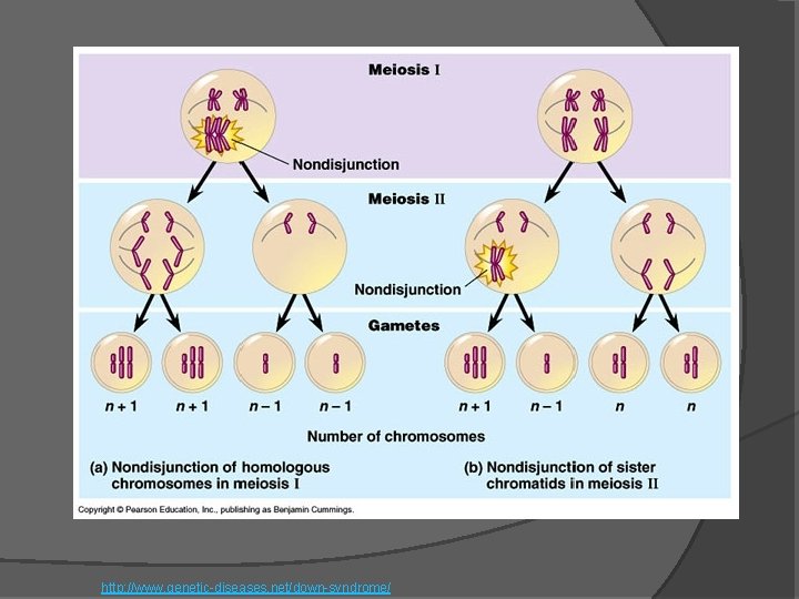 http: //www. genetic-diseases. net/down-syndrome/ 