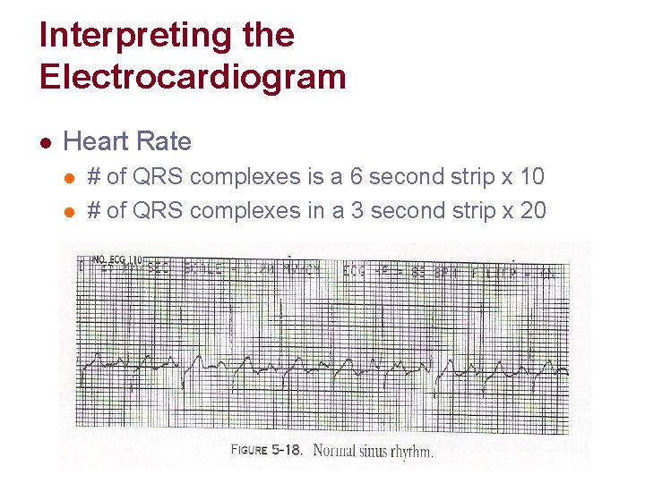 Interpreting the Electrocardiogram l Heart Rate l l # of QRS complexes is a