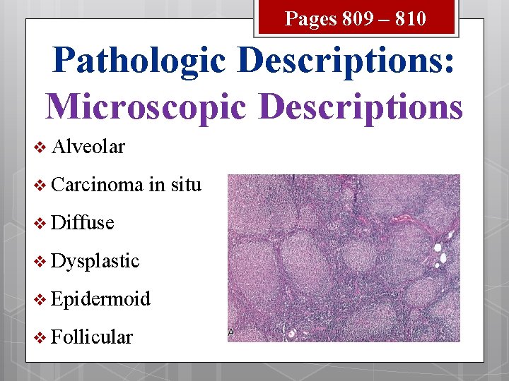 Pages 809 – 810 Pathologic Descriptions: Microscopic Descriptions v Alveolar v Carcinoma in situ