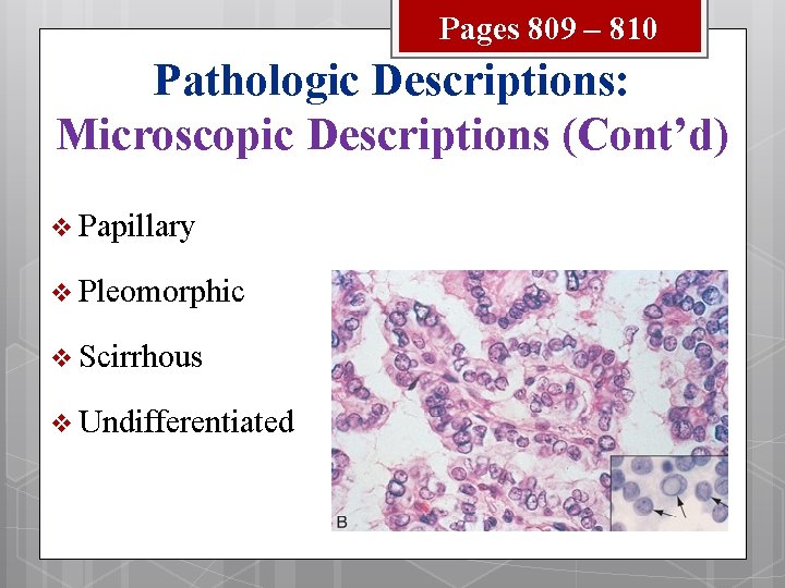 Pages 809 – 810 Pathologic Descriptions: Microscopic Descriptions (Cont’d) v Papillary v Pleomorphic v