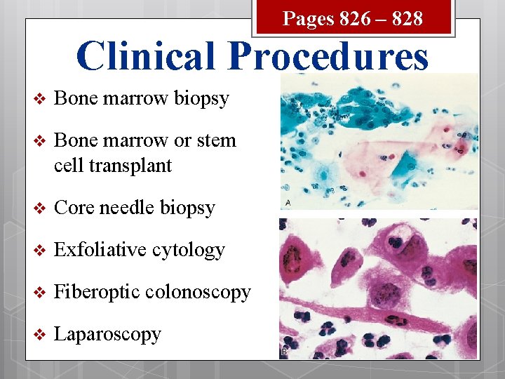 Pages 826 – 828 Clinical Procedures v Bone marrow biopsy v Bone marrow or