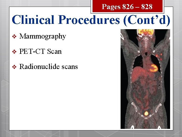 Pages 826 – 828 Clinical Procedures (Cont’d) v Mammography v PET-CT Scan v Radionuclide