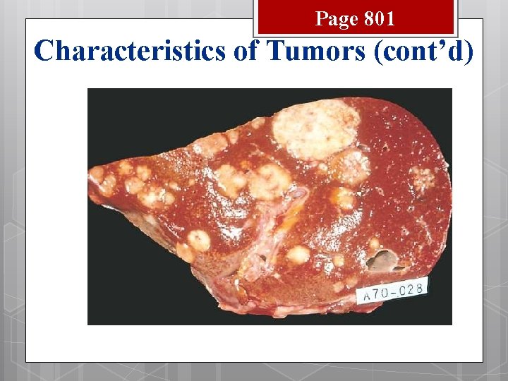 Page 801 Characteristics of Tumors (cont’d) 