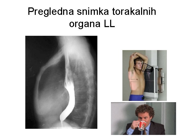 Pregledna snimka torakalnih organa LL 