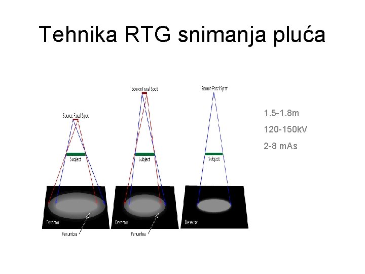 Tehnika RTG snimanja pluća 1. 5 -1. 8 m 120 -150 k. V 2