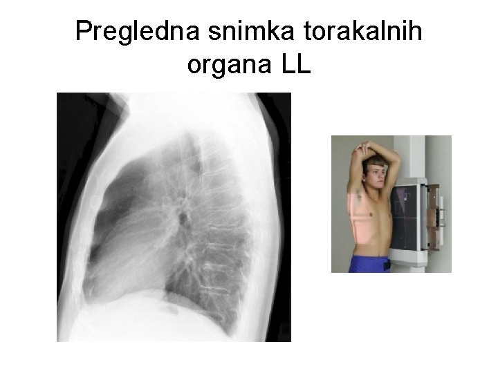 Pregledna snimka torakalnih organa LL 