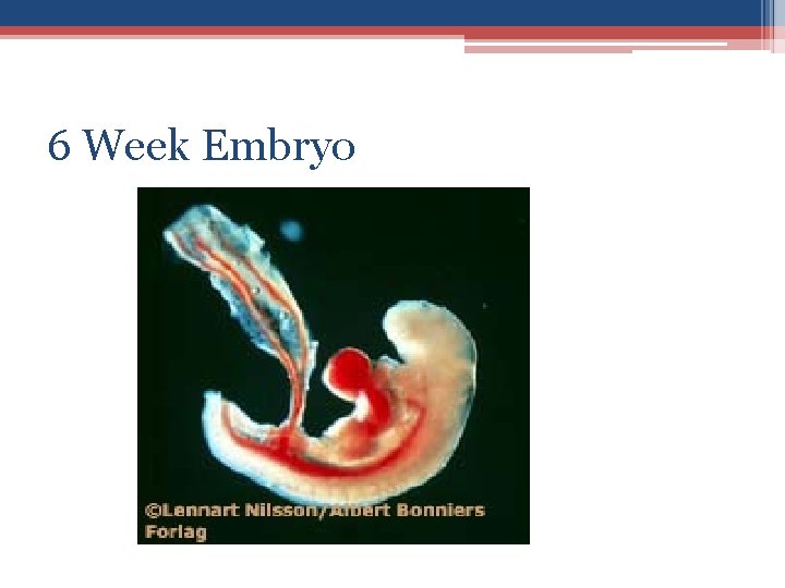 6 Week Embryo 