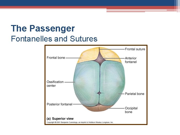 The Passenger Fontanelles and Sutures 